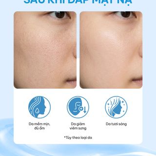 Mặt nạ dưỡng da   WOONG HYE EXOCICA MASK