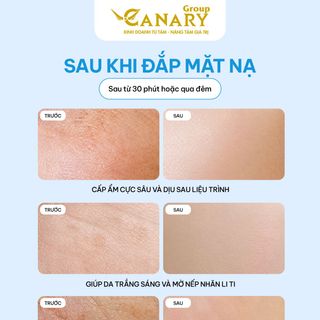 Mặt nạ dừa  Fresh Coconut Vietnam Mask