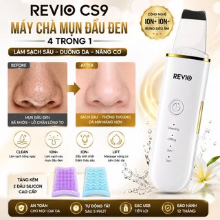Máy chà mụn đầu đen công nghệ ion+- đẩy mụn sâu