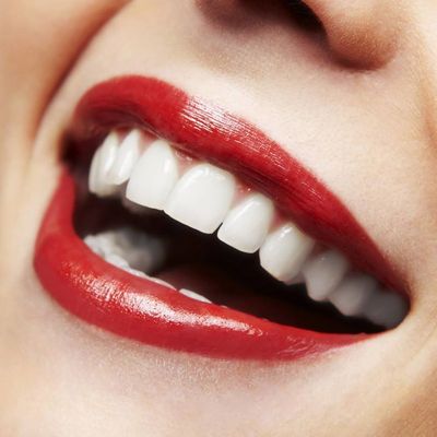 Miếng Dán Trắng Răng