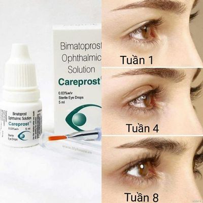 Dưỡng mi Careprost