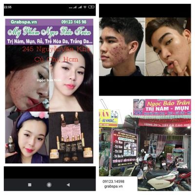 Mỹ phẩm Ngọc Bảo Trân