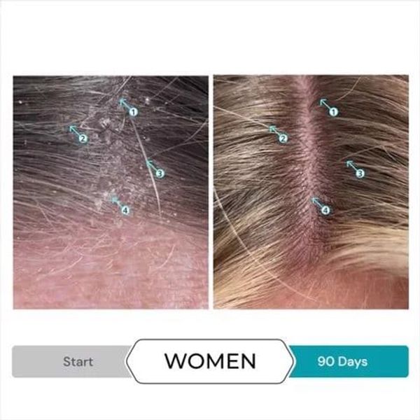 DANDRENE ANTI - DANDRUFF CONDITIONER 205ml - Dầu xả nuôi dưỡng, trị gầu, vảy nến. DANDRENE ANTI - DANDRUFF CONDITIONER 205ml - Dầu xả nuôi dưỡng, trị gầu, vảy nến.
