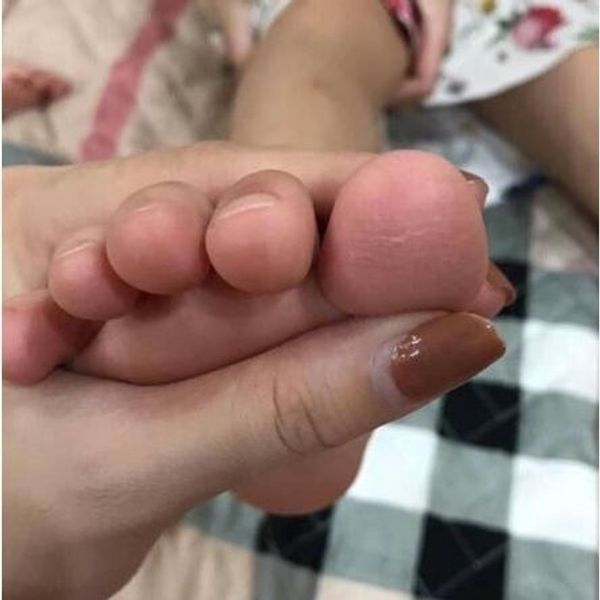 Kem thảo dược bôi ngoài da: nứt nẻ, nấm ngứa, vảy nến, á sừng cực kỳ hiệu quả - CTB798 Kem thảo dược bôi ngoài da: nứt nẻ, nấm ngứa, vảy nến, á sừng cực kỳ hiệu quả - CTB798