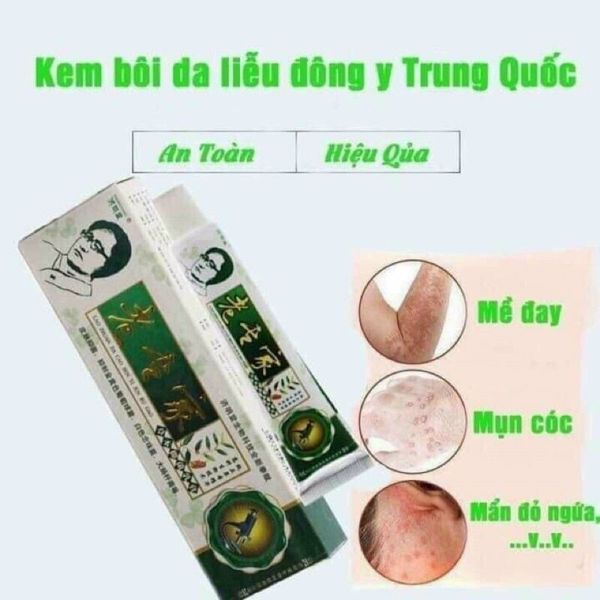 Kem thảo dược bôi ngoài da: nứt nẻ, nấm ngứa, vảy nến, á sừng cực kỳ hiệu quả - CTB798 Kem thảo dược bôi ngoài da: nứt nẻ, nấm ngứa, vảy nến, á sừng cực kỳ hiệu quả - CTB798