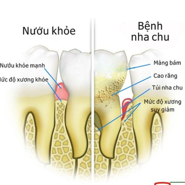 HỘP TĂM CHỈ NHA KHOA TIỆT TRÙNG SỢI CHỈ VỆ SINH RĂNG MIỆNG 1 HỘP 50 CHIẾC GD099 - LADY'S PASSION HỘP TĂM CHỈ NHA KHOA TIỆT TRÙNG SỢI CHỈ VỆ SINH RĂNG MIỆNG 1 HỘP 50 CHIẾC GD099 - LADY'S PASSION