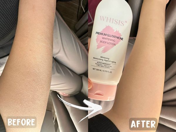 vitamin e and glutathione together Amazon.com : Guliqi Glutathione 50x Tone Up Body Lotion, Body Lotion Premium  Ultra White, Glutathione Cream for Women (2) : Beauty & Personal Care main image 1